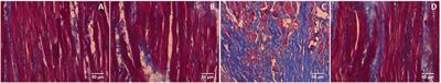 Galangin Attenuates Isoproterenol-Induced Inflammation and Fibrosis in the Cardiac Tissue of Albino Wistar Rats